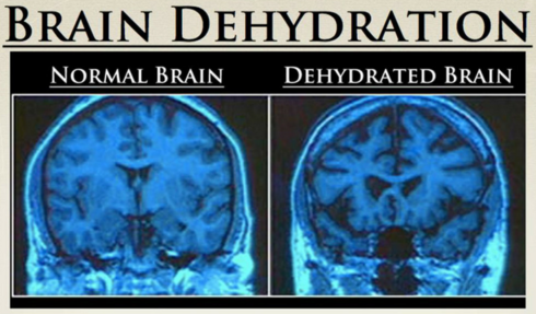 DEHYDRATION AND MORE SODIUM INTAKE CAN CAUSE SEIZURES