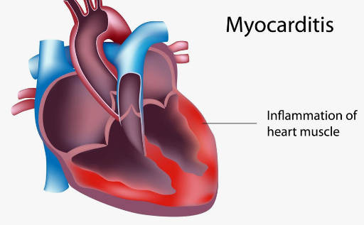 COVID-19 CAUSES LONG TERM DAMAGE